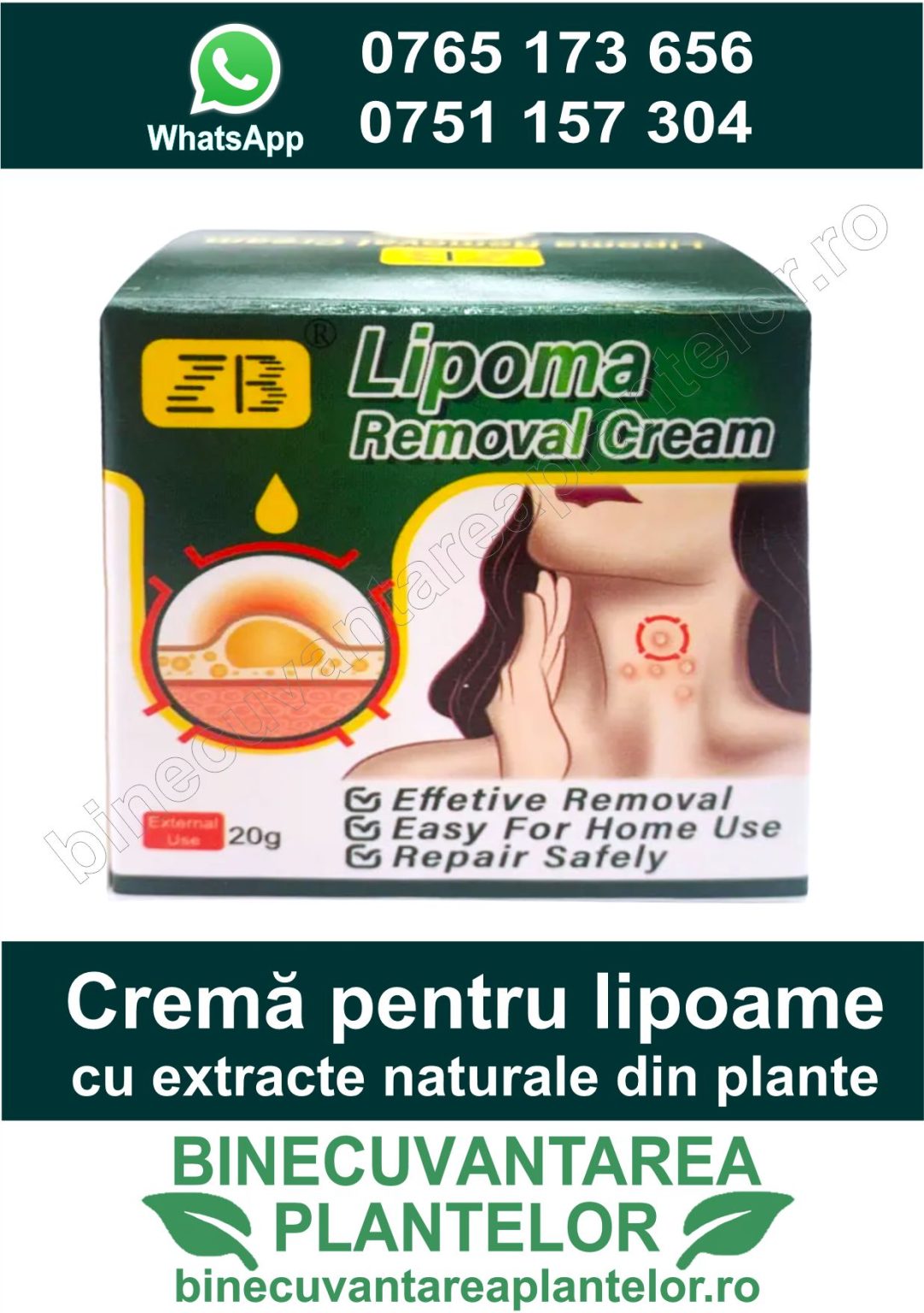 Cremă pentru lipoame